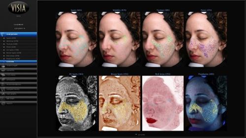 Wrinkles, sun damage & acne scars: This machine revealed all of the flaws on my face