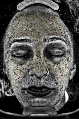 Wrinkles, sun damage & acne scars: This machine revealed all of the flaws on my face