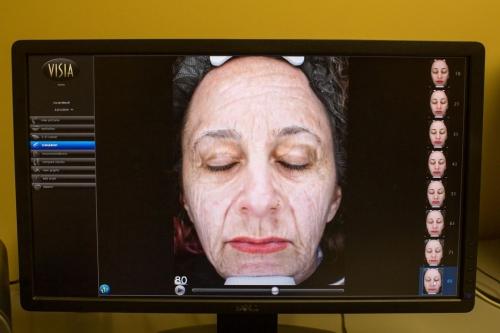 Wrinkles, sun damage & acne scars: This machine revealed all of the flaws on my face